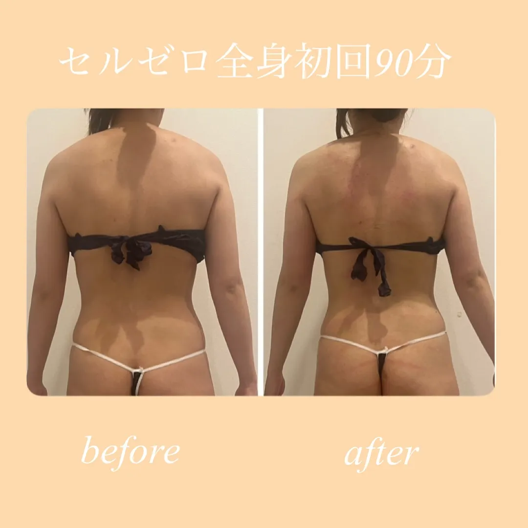 多くの方に人気のセルゼロ✨ブライダルを控えた方にも特に人気で...