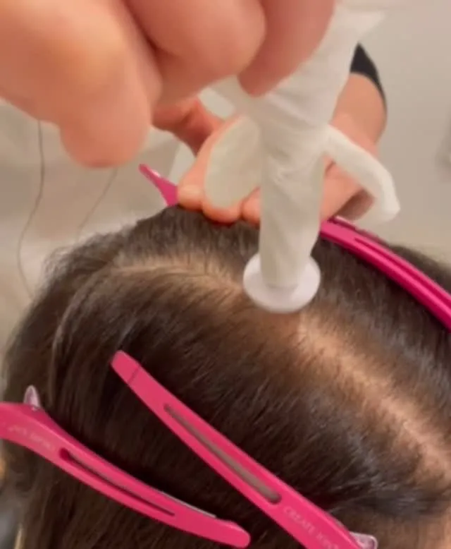 劇的に改善に導く【プロセルセラピーズ】